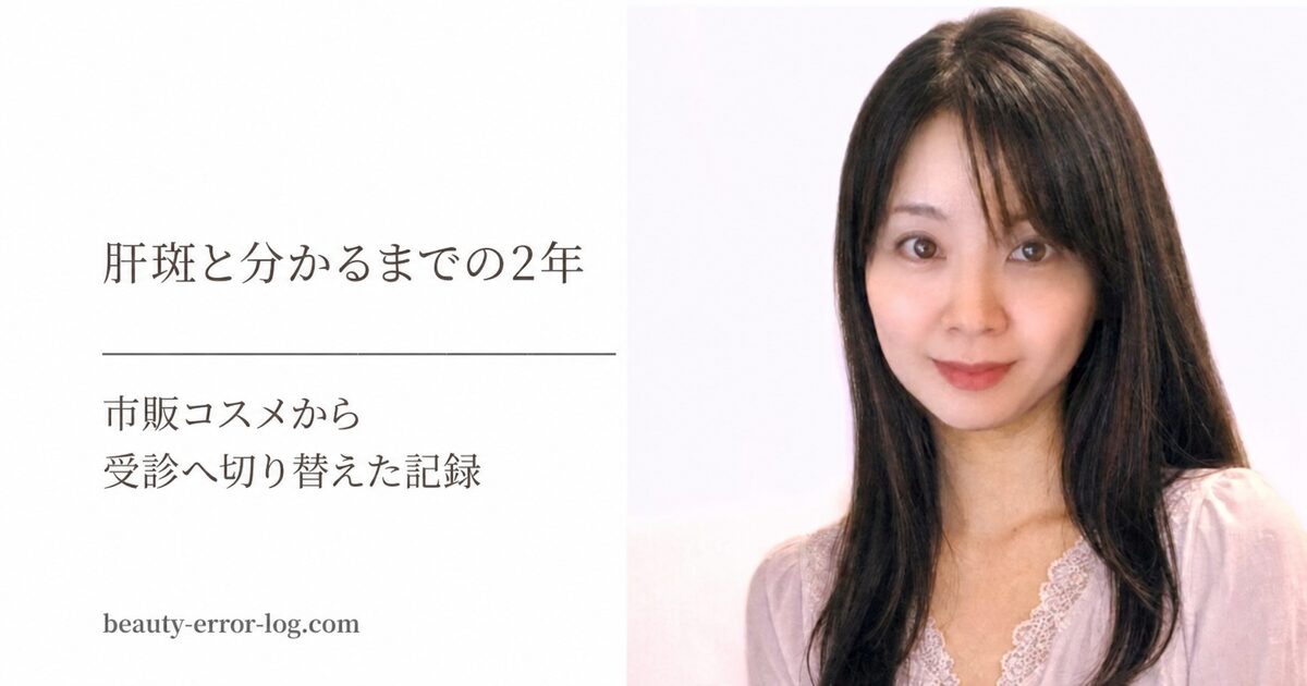 肝斑と分かるまで市販コスメを試した2年と、受診へ切り替えた記録